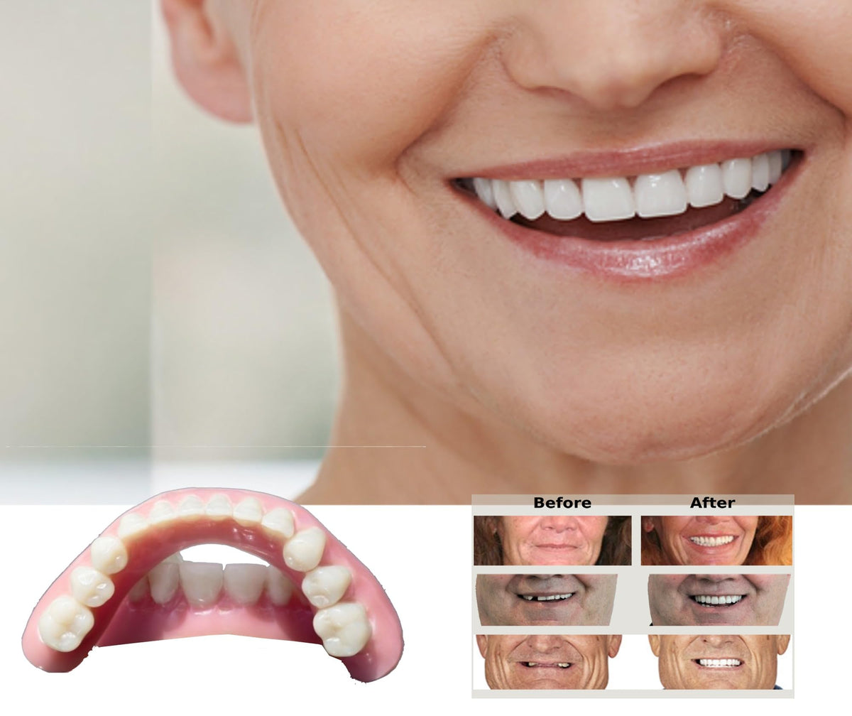DIY Dentures Kit Y33549