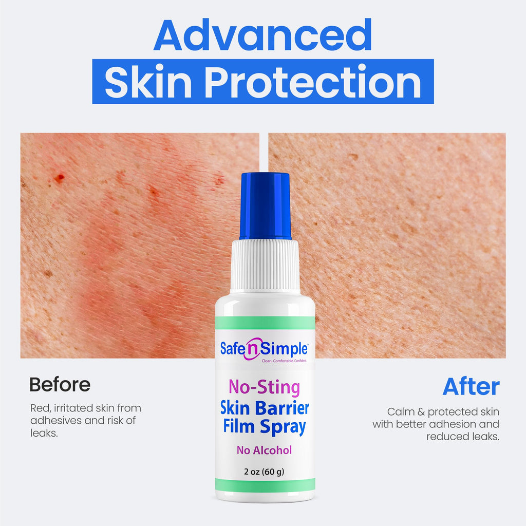 Skin Barrier Spray 2oz Alcohol-Free W863